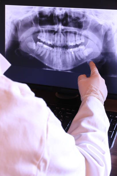 Best Emergency Wisdom Teeth Removal in Wenatchee, WA